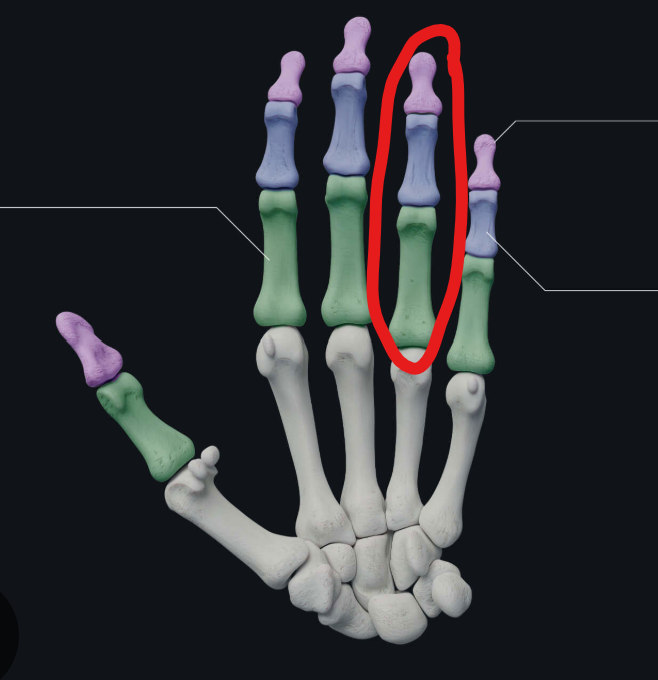 <p>Enable finger movement</p>