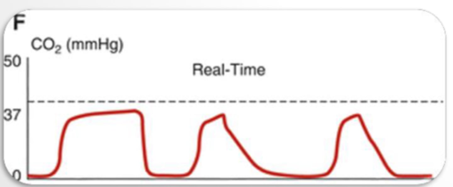 <p>What could explain the capnograph?</p>