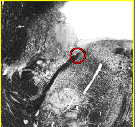 term image