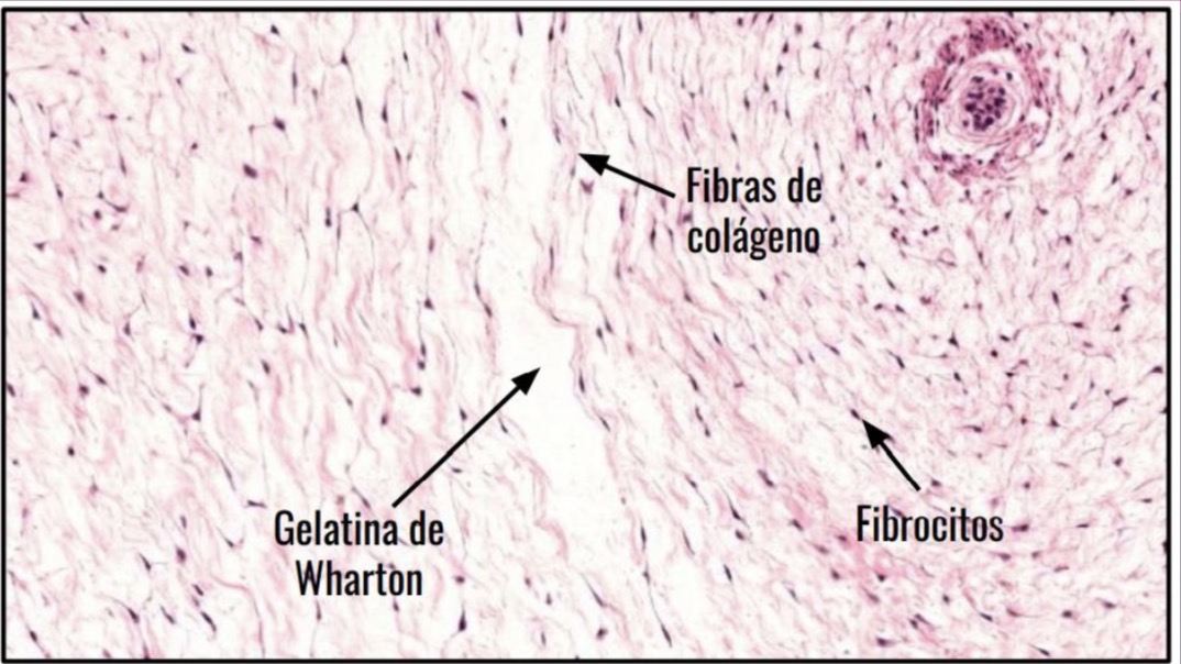 <p>Sustancia intercelular amorfa tinción hematoxilina eosina </p>
