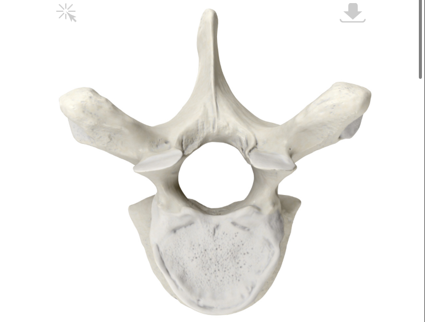 <p>Wat voor type wervel is dit?</p>