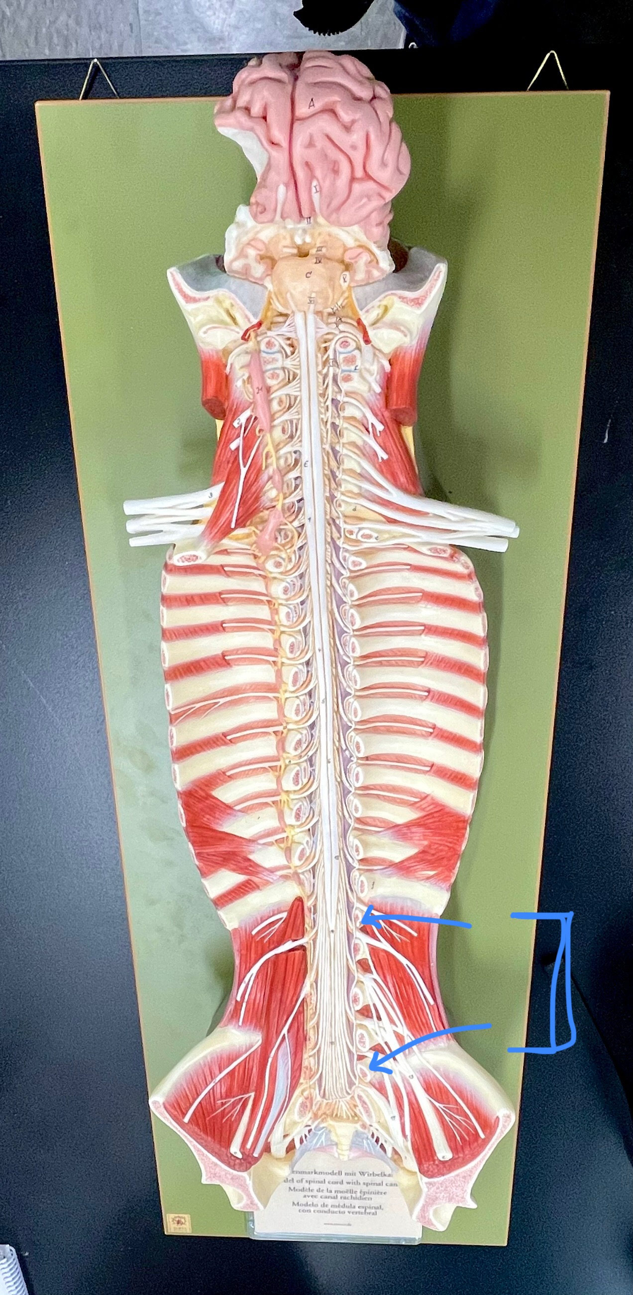 <p>What type of spinal nerve is this? How many pairs?</p>