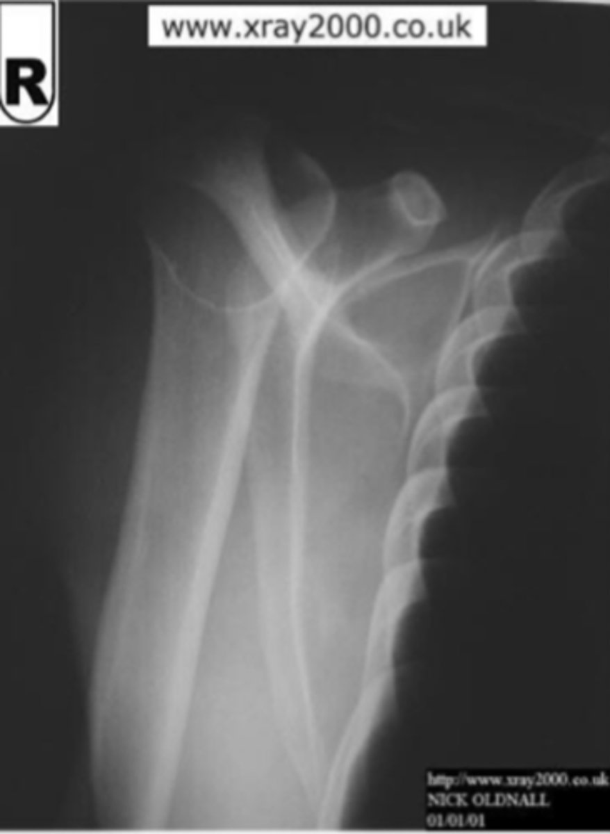 <p>What is the issue?</p>