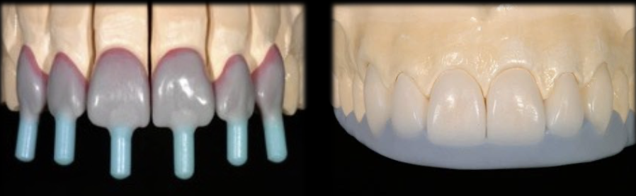 <p>Leucite-Reinforced Glass Properties</p>