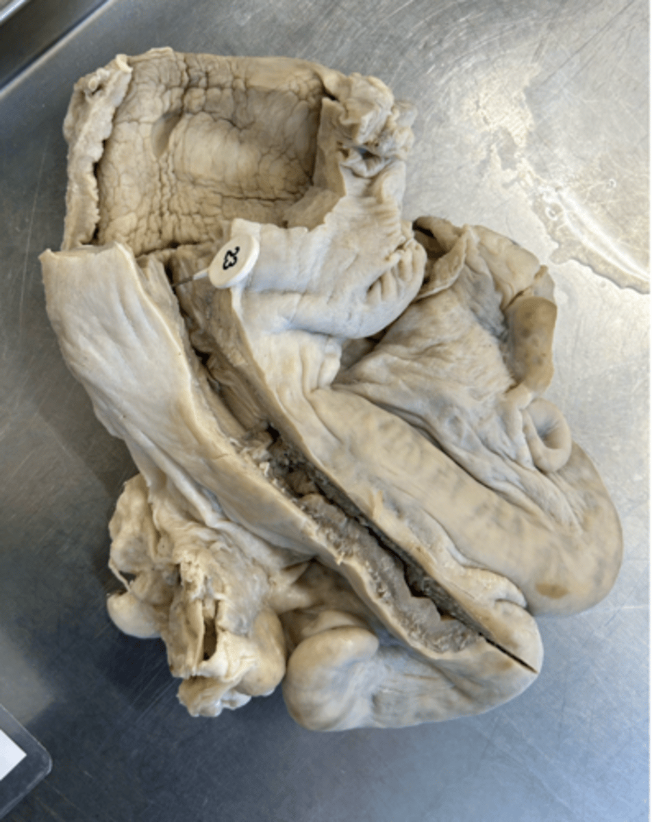 <p>ID the connective tissue structures present in this region.</p>
