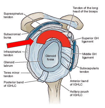 <p>Superior Labral Tears Anterior to Posterior (SLAP) MOI</p>