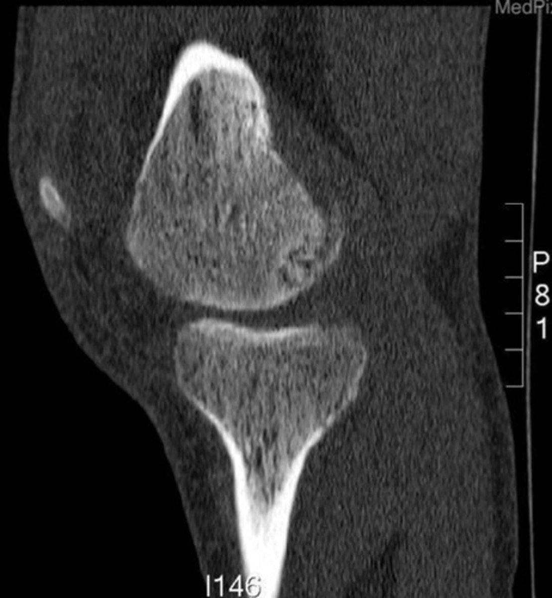 <p>What view of a CT is this?</p>