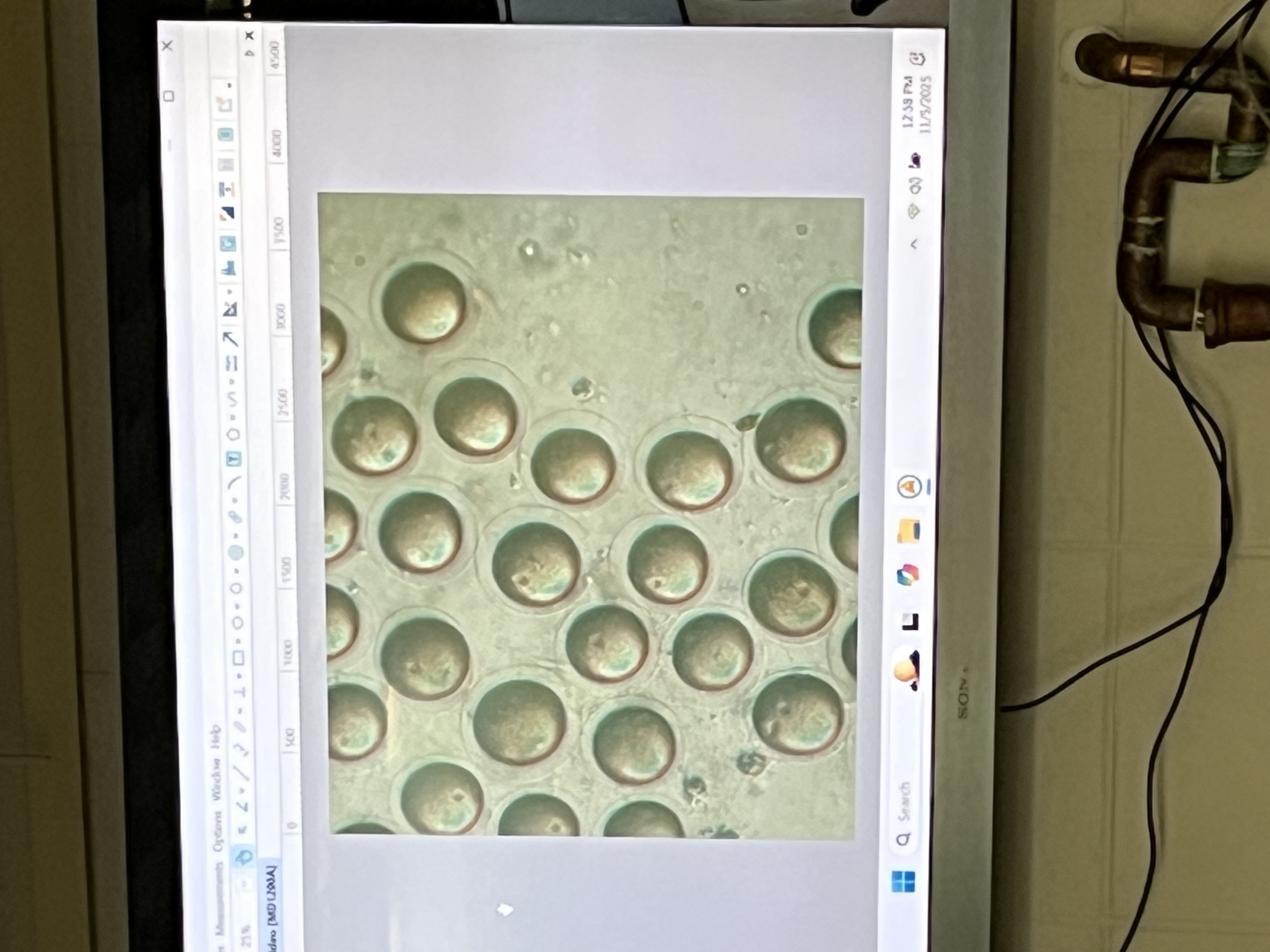 <p>What’s the clear ring around the egg called?</p>