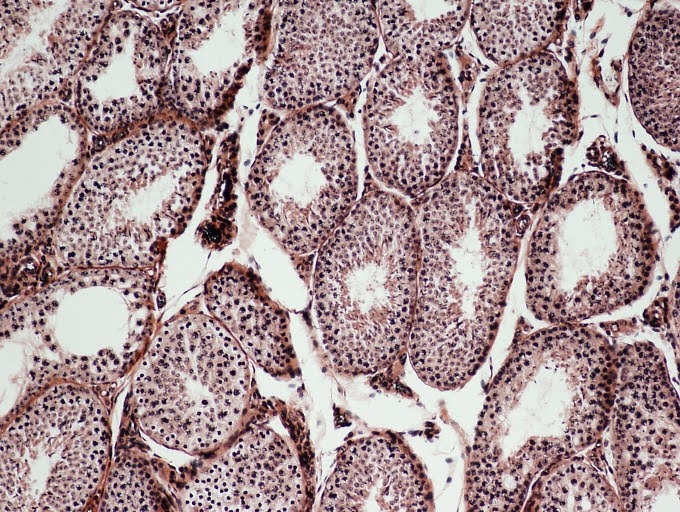 <p><span><span>Identify the pictured endocrine organ.</span></span></p>