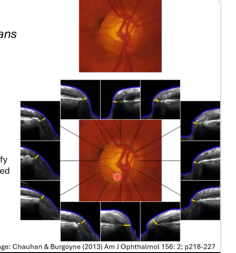 <p>can therefore sometimes identify areas of thinner rim than subjectively assessed</p><p>useful in glaucoma </p>