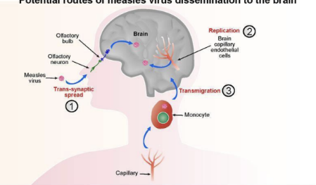 <p>Yes. Primary = virus directly invades CNS (HSV, arboviruses, rabies).<br>Secondary = reactivation or complication (measles → SSPE, human coronaviruses).</p>