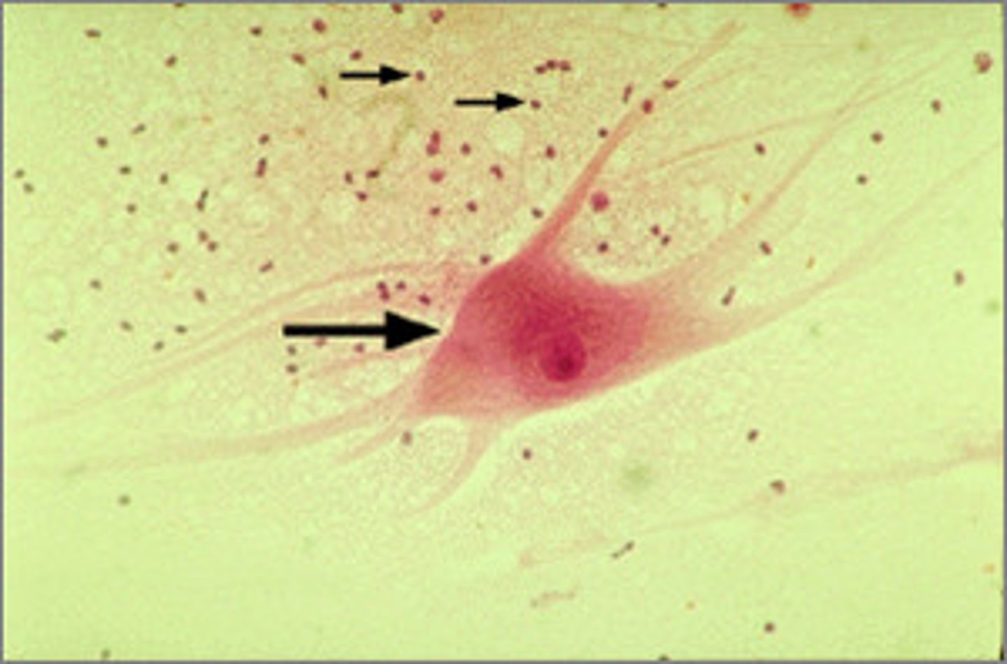 <p>cells that support and protect neurons</p>