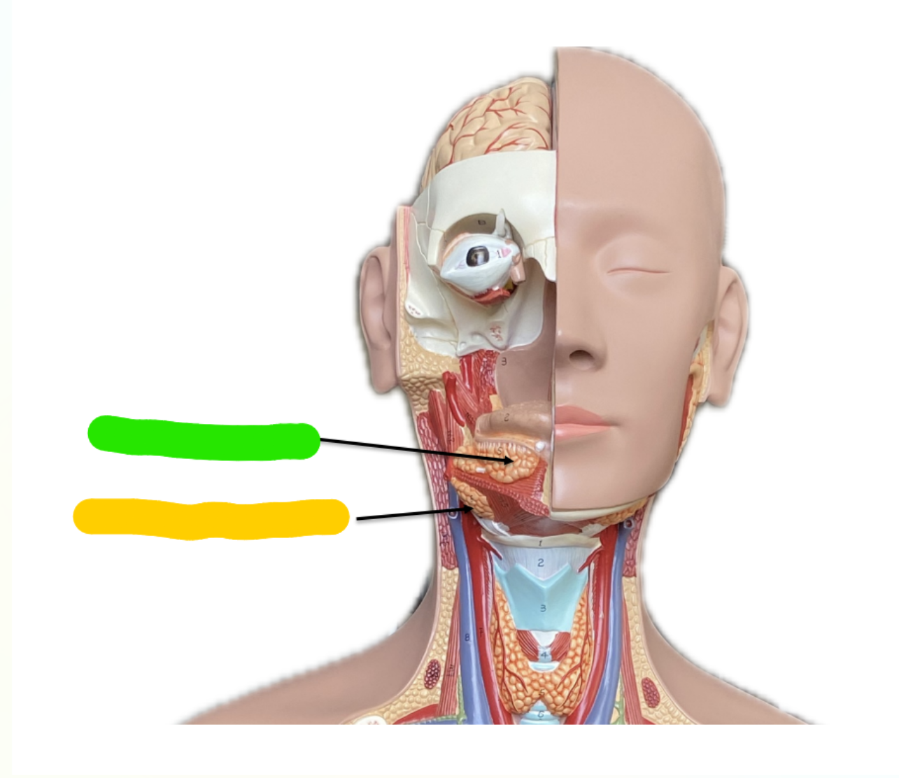 <p>What is indicated by the Yellow Section?</p>