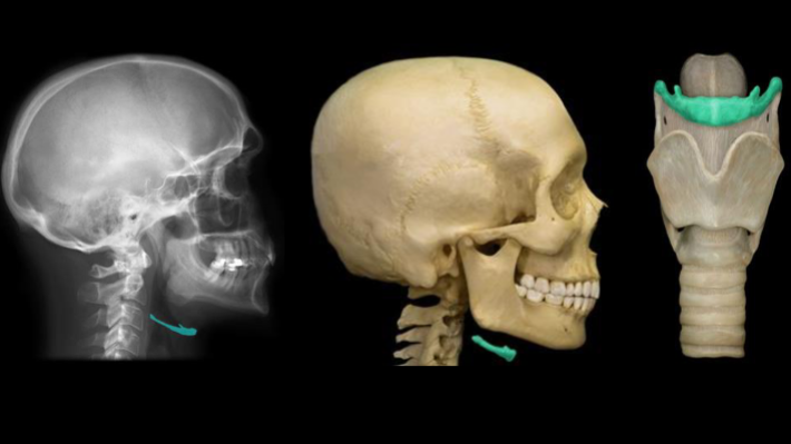 <p>What is the “floating bone under the jaw” that is highlighted in this image called?</p>