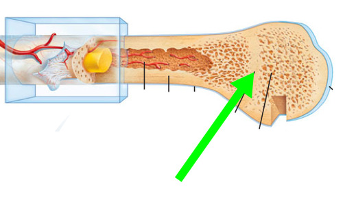 <p>between diaphysis and epiphysis of an adult bone. A disc of hyaline cartilage that grows during childhood to lengthen bone.</p>