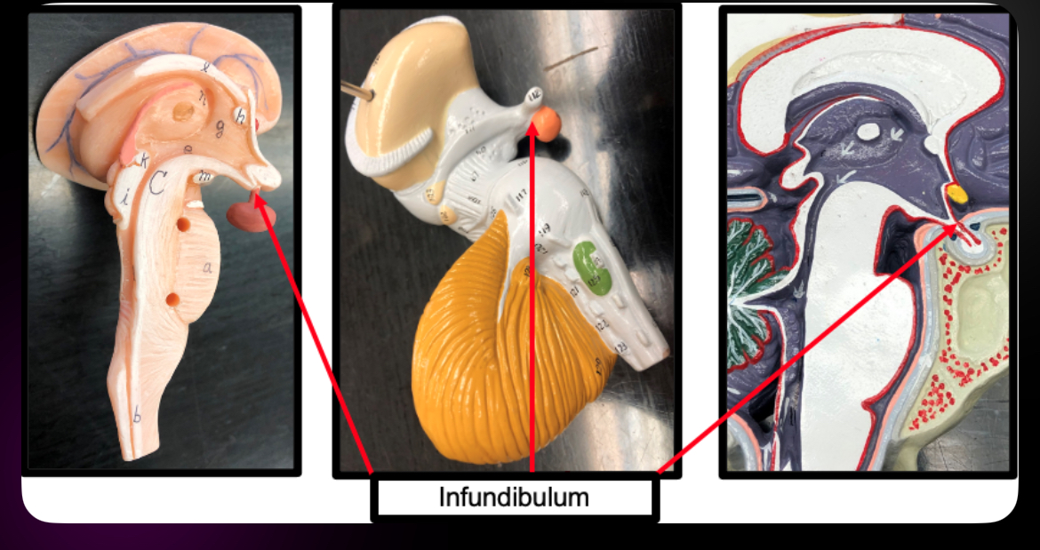 <p>Infundibulum</p>