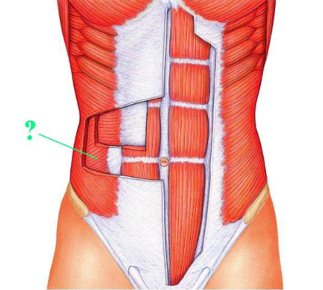 <p><span>Identify the indicated muscle.</span></p>