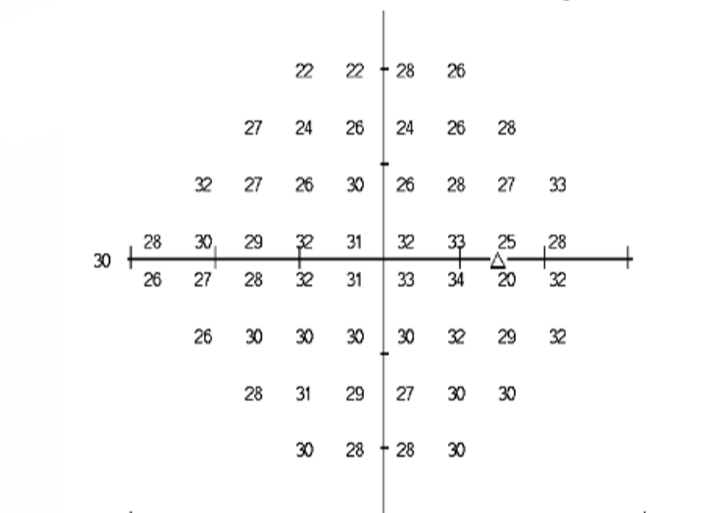 <p>What does this visual field plot show us</p>
