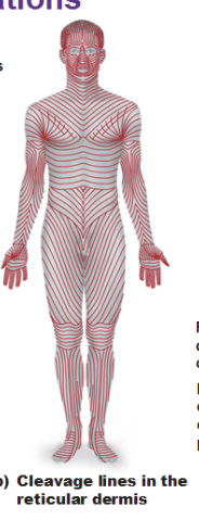 <p>Cleavage (tension) lines </p>