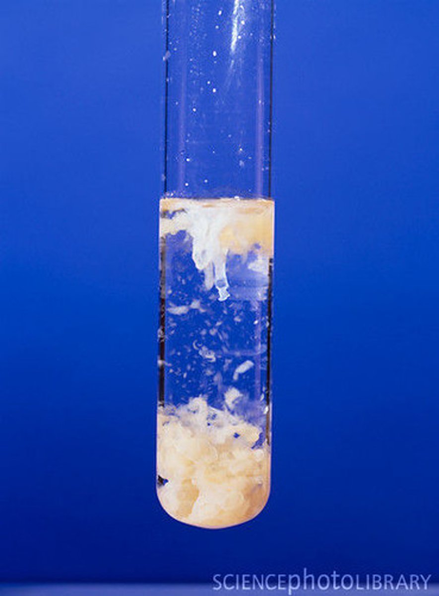 <p>MgNH<sub>4</sub>PO<sub>4</sub>6H<sub>2</sub>O</p><p>^finding this mass will help you find mass % of phosphorus</p>