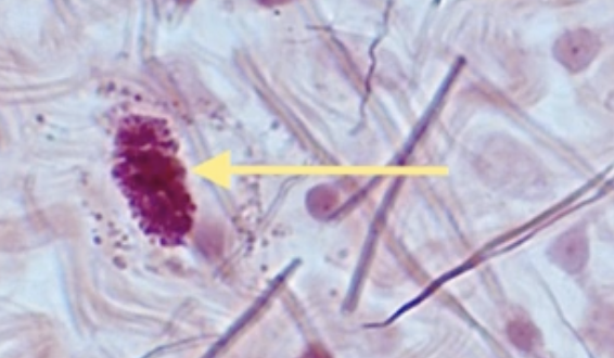 <p>What type of cell is the arrow pointing to?</p>