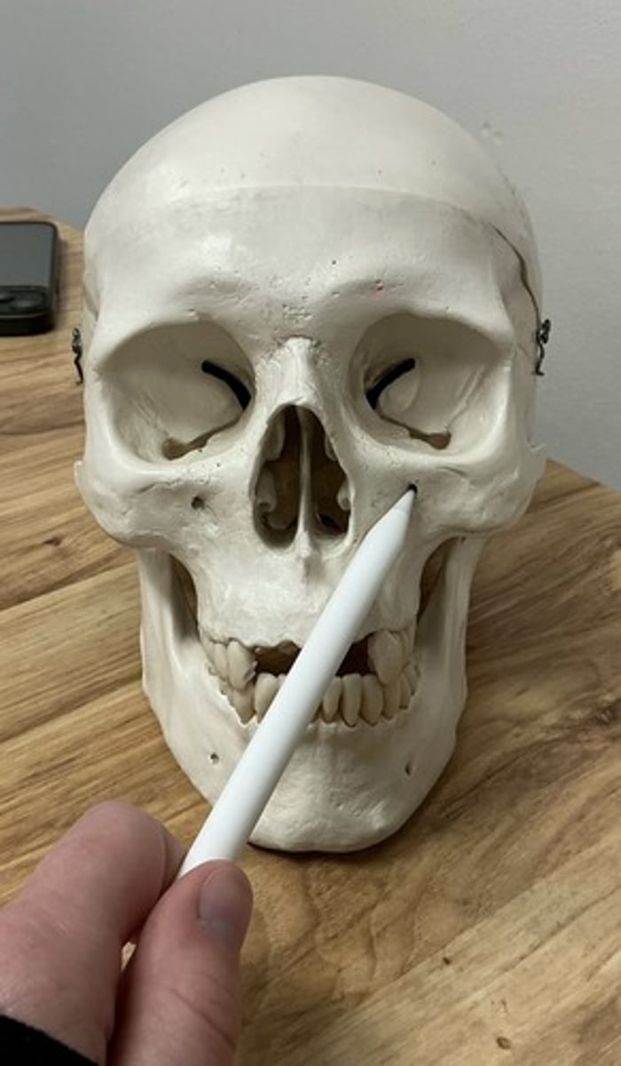 <p>What is the arrow pointing to?</p>