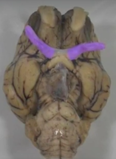 what part of the brain is this?