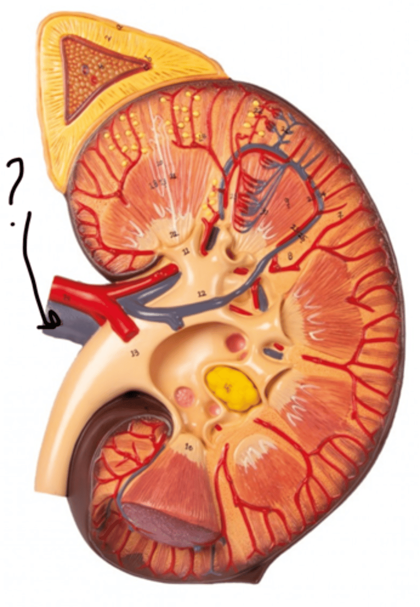 <p>Name this vessel.</p>