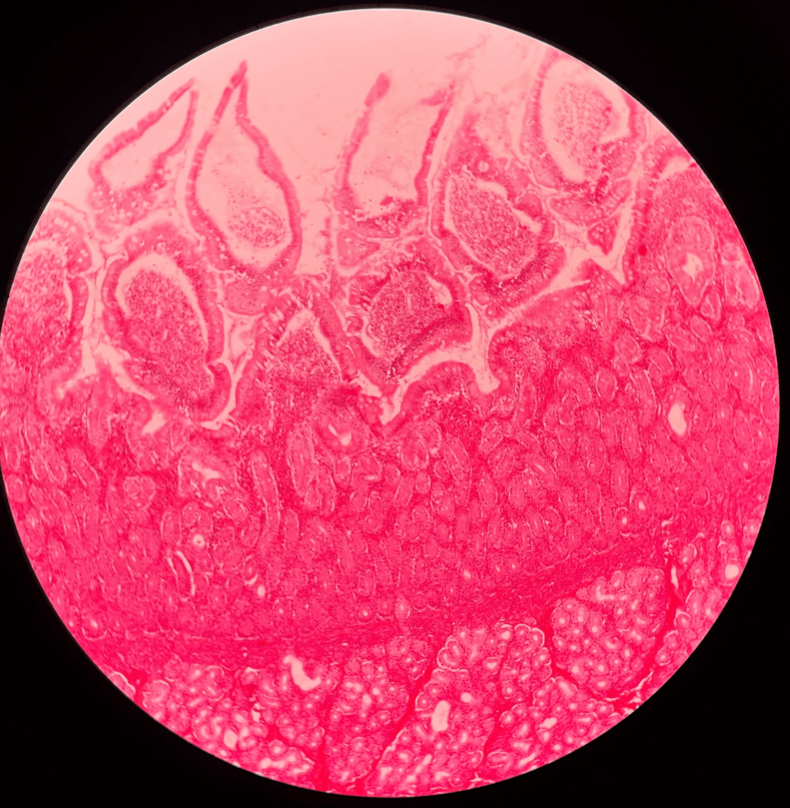 • Slide histology.

• The proximal region of the small intestine.