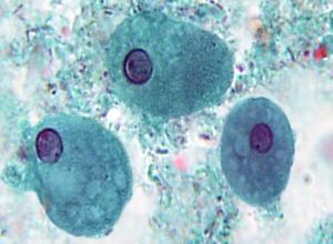 E. coli trophozoites