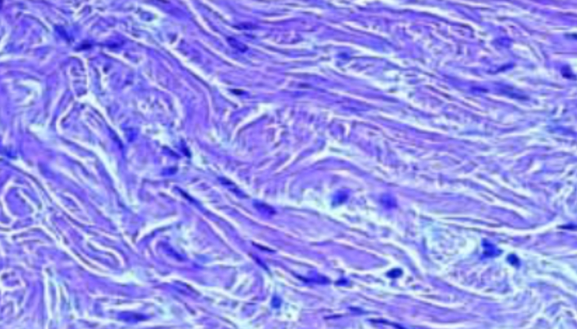 <p>Dense irregular COnnective tissue ( dense conn tissue)</p>