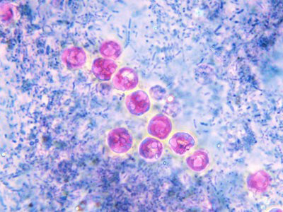 <p>immediately infectious</p>