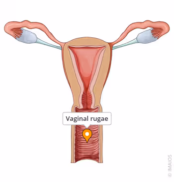 <p>Female (rug.o.vag)</p>