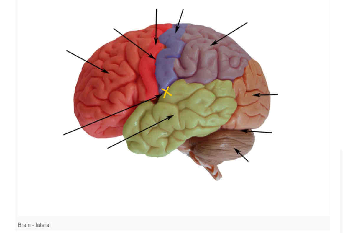 term image