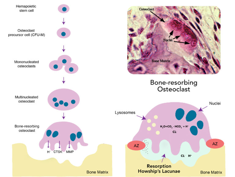 <p><strong>In Howship’s lacunae (aka resorption pit),</strong> indentations in compact bone caused by their reabsorption activity.</p>