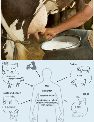 <ul><li><p><strong>Contaminated food</strong> (especially unpasteurized dairy).</p></li><li><p><strong>Inhalation of infected animal tissues</strong> (e.g., slaughterhouse exposure).</p></li><li><p><strong>Rarely, person-to-person transmission</strong>.</p></li></ul><p></p>