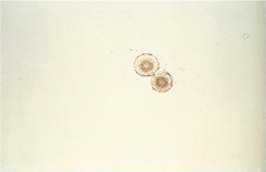 <ul><li><p><span>Yellow-brown spheres with concentric circles and radial striations</span></p></li><li><p><span>Accompanied by tyrosine crystals</span></p></li><li><p>Liver disease</p></li><li><p>Acid/neutral</p></li></ul><p></p>