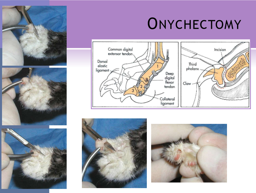 <ul><li><p>cats </p></li><li><p>removal of the 3rd digital phalanx (P3) </p><ul><li><p>complication rate ~20% </p></li></ul></li><li><p>elective - usually performed between 3-12 mo </p><ul><li><p>young tolerate the procedure better than old </p></li></ul></li><li><p>front or all four limbs educate owners </p></li><li><p>alternatives : nail trim, caps, outdoor cat </p></li><li><p>surgical procedure </p><ul><li><p>local / ring block to provide additional analgesia </p></li><li><p>place a tourniquet </p><ul><li><p>radial neuropathy </p><ul><li><p>limit time </p></li></ul></li></ul></li><li><p>scalpel </p><ul><li><p>all of P3 is removed by surgical dissection </p></li></ul></li><li><p>resco nail clipper </p><ul><li><p>better chance of leaving ungual crest </p></li><li><p>can get persistent pain/lameness from remaining bone </p></li></ul></li><li><p>CO2 laser </p><ul><li><p>less bleeding </p></li><li><p>faster healing </p></li><li><p>smaller incision </p></li><li><p>disadvantage; laser is expensive </p></li></ul></li></ul></li><li><p>sutures </p><ul><li><p>absorbable, monofilament </p></li><li><p>single for skin apposition </p></li></ul></li><li><p>postoperative care </p><ul><li><p>bandages x 24 hours </p></li><li><p>paper litter </p></li></ul></li><li><p>complications </p><ul><li><p>hemorrhage, infection </p></li><li><p>claw re-growth, lameness from remaining bone </p></li><li><p>pad injury, tissue necrosis </p></li></ul></li></ul><p></p>
