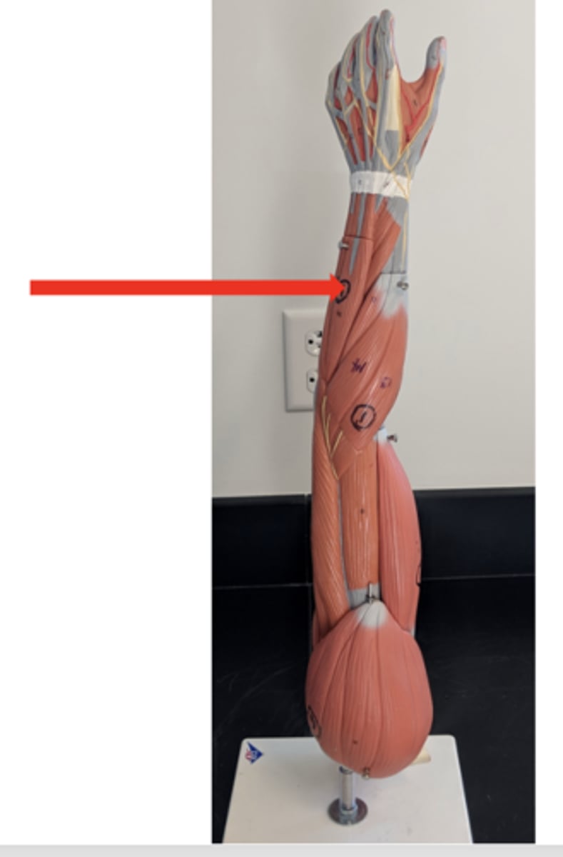 <p>what is this?</p>