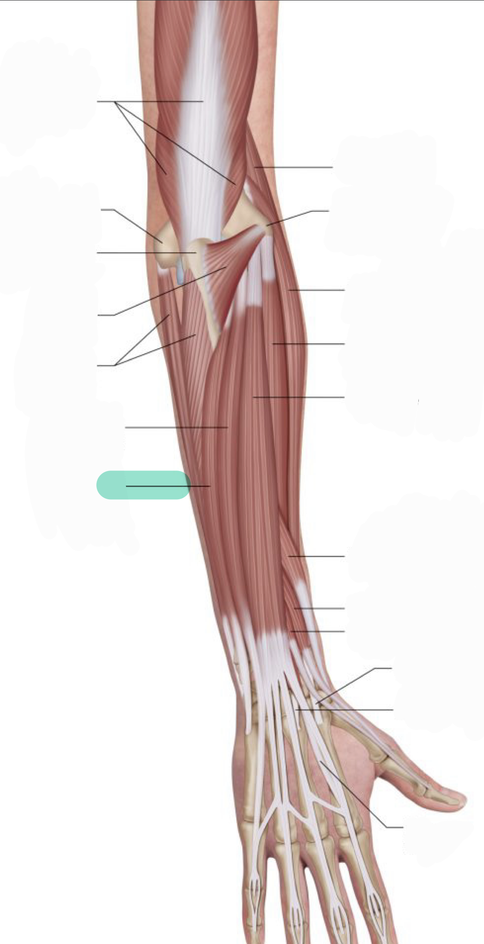 <p>Extends and ADducts wrist; acts with Flexor carpi ulnaris to ADduct wrist</p>