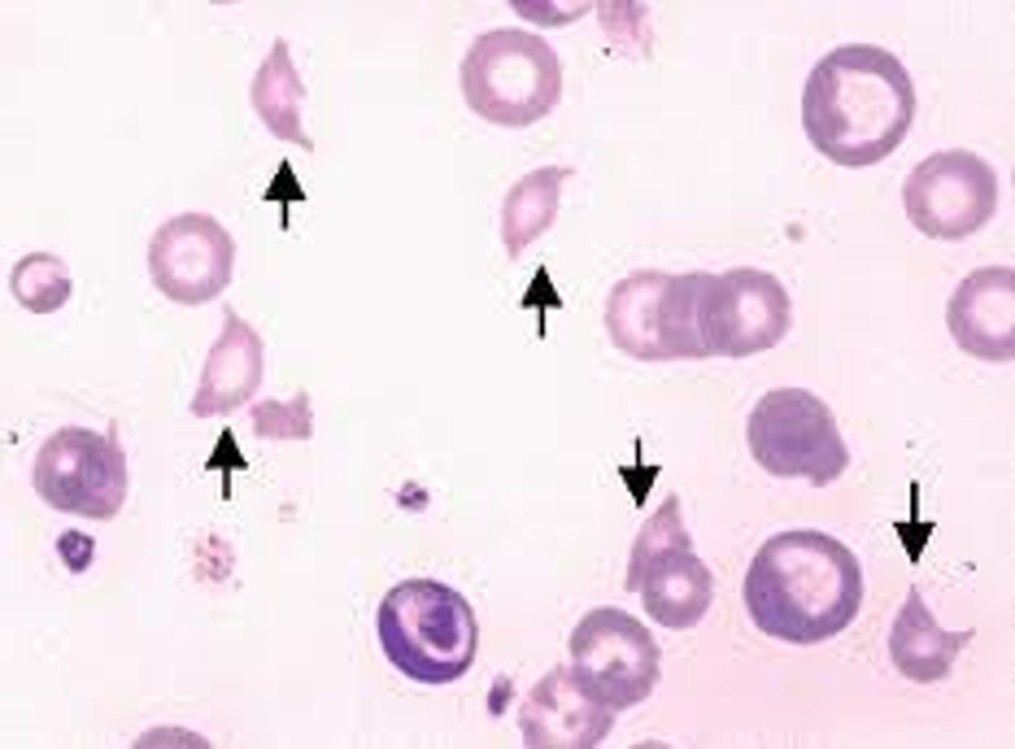 <p>schistocyte</p>