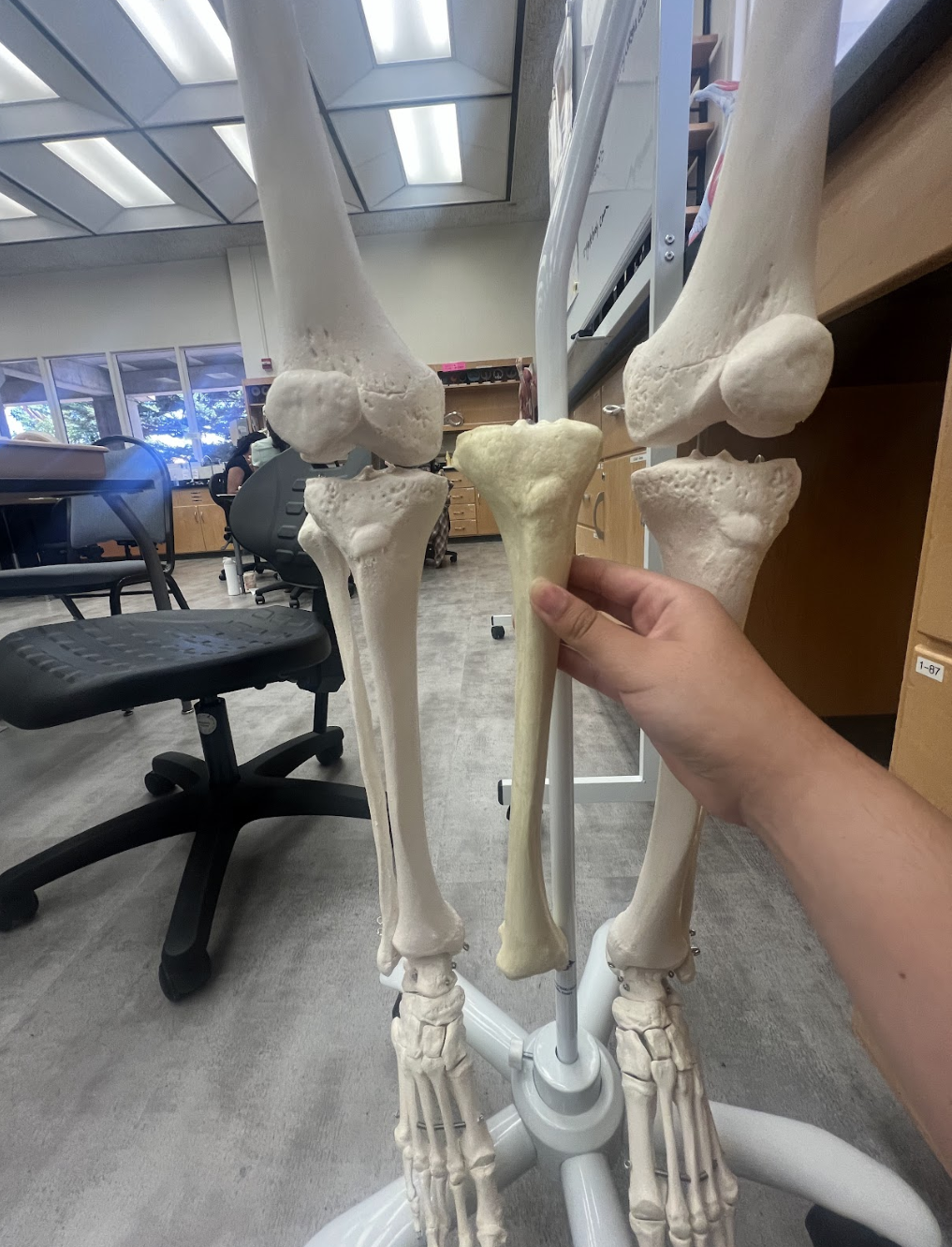 <p>Left or right tibia…..</p>