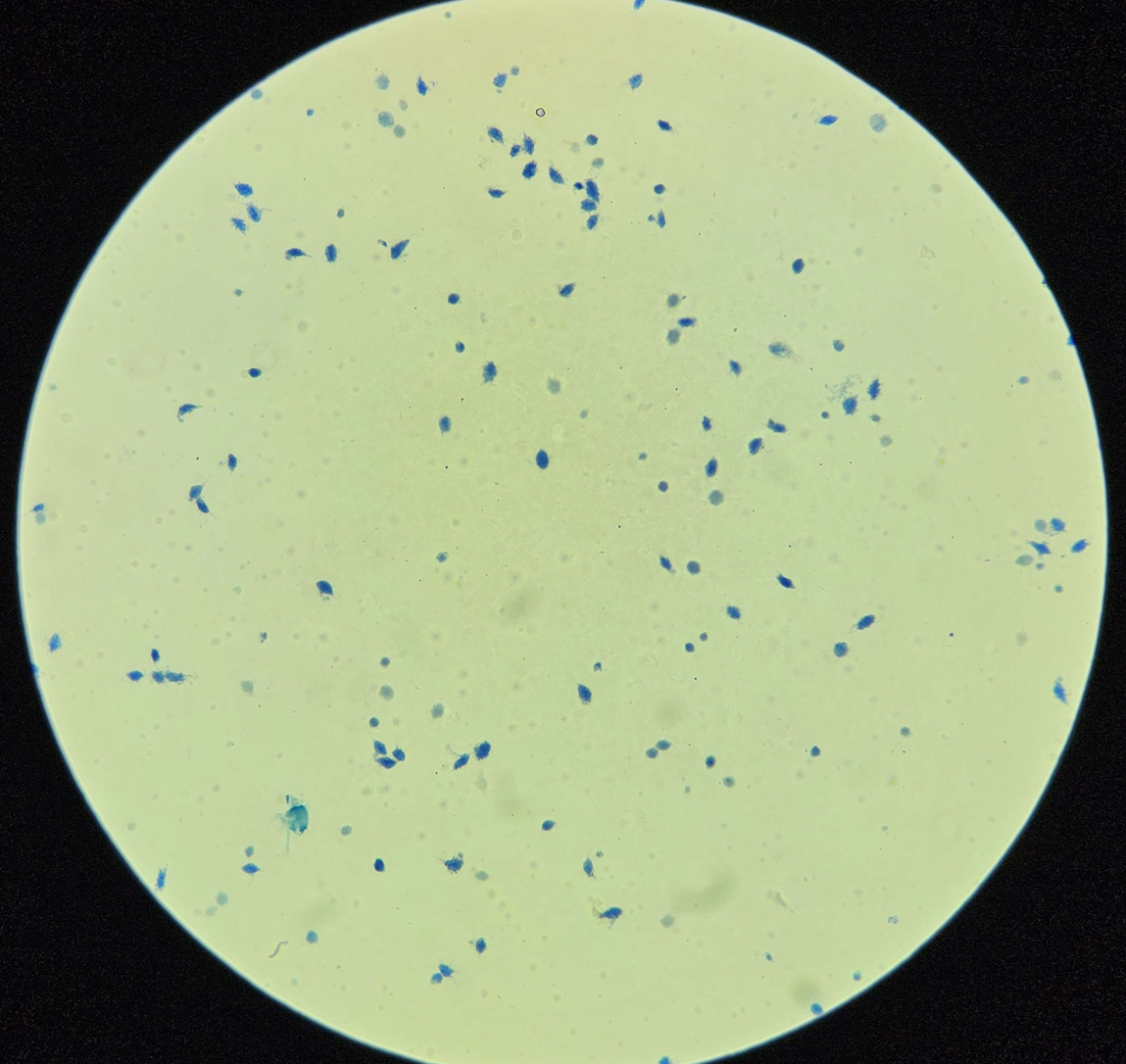 <p><span data-name="microscope" data-type="emoji">🔬</span><span data-name="petri_dish" data-type="emoji">🧫</span><strong><span> </span>Na podstawie zdjęcia preparatu:</strong></p><p></p><ul><li><p><span data-name="book" data-type="emoji">📖</span><span> </span>rozpoznaj gatunek pasożyta;</p></li></ul><p></p><ul><li><p><span data-name="recycle" data-type="emoji">♻</span><span> </span>rozpoznaj wszystkie formy rozwojowe;</p></li></ul><p></p><ul><li><p><span data-name="microbe" data-type="emoji">🦠</span><span> </span>wskaż organelle i cechy charakterystyczne dla danego gatunku;</p></li></ul><p></p><ul><li><p><span data-name="mask" data-type="emoji">😷</span><span> </span>nazwij chorobę, którą pasożyt wywołuje.</p></li></ul><p></p>