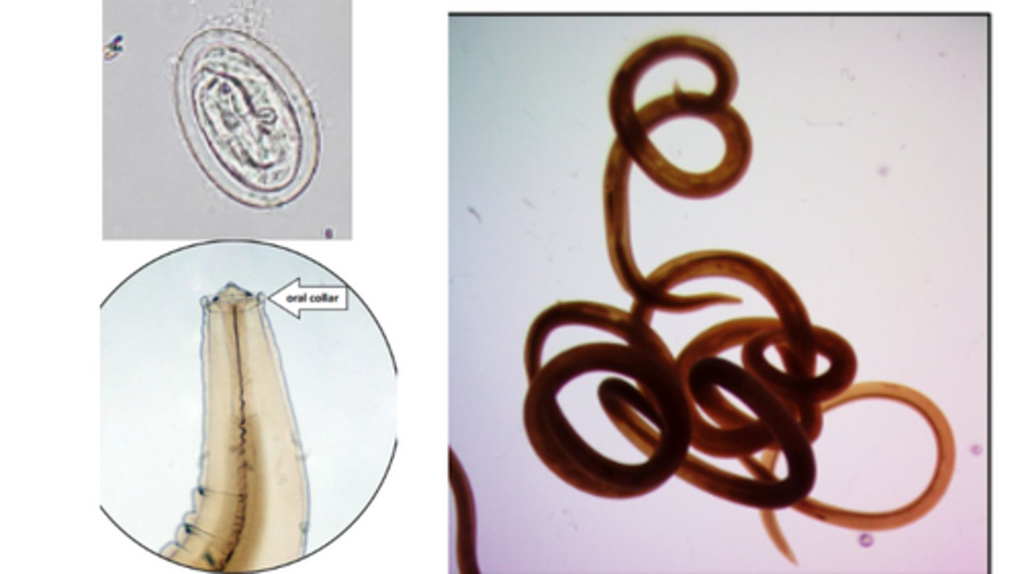 <p>Nematode in dogs & cats with thick shelled eggs that contain L1 larvae</p><p>-Length of eggs is 2x their width</p><p>*Best recovered using a fecal sedimentation technique due to their high density; adults found on endoscopy or in vomit</p>