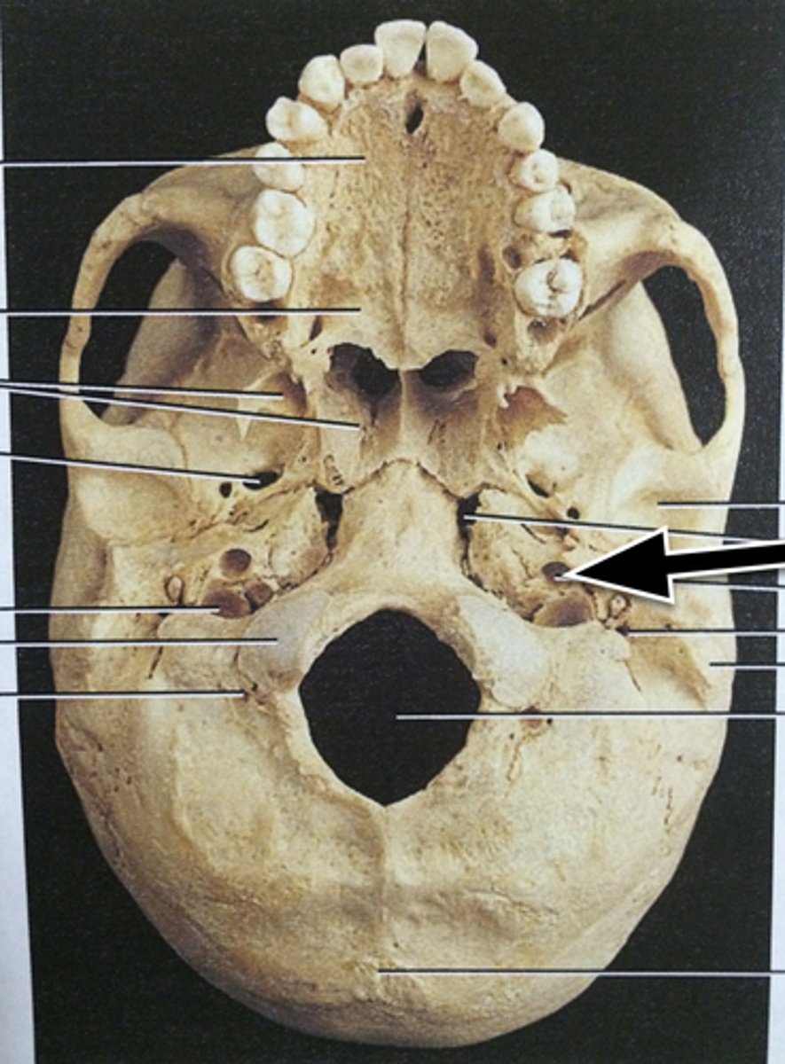 <p>opening for carotid artery</p>
