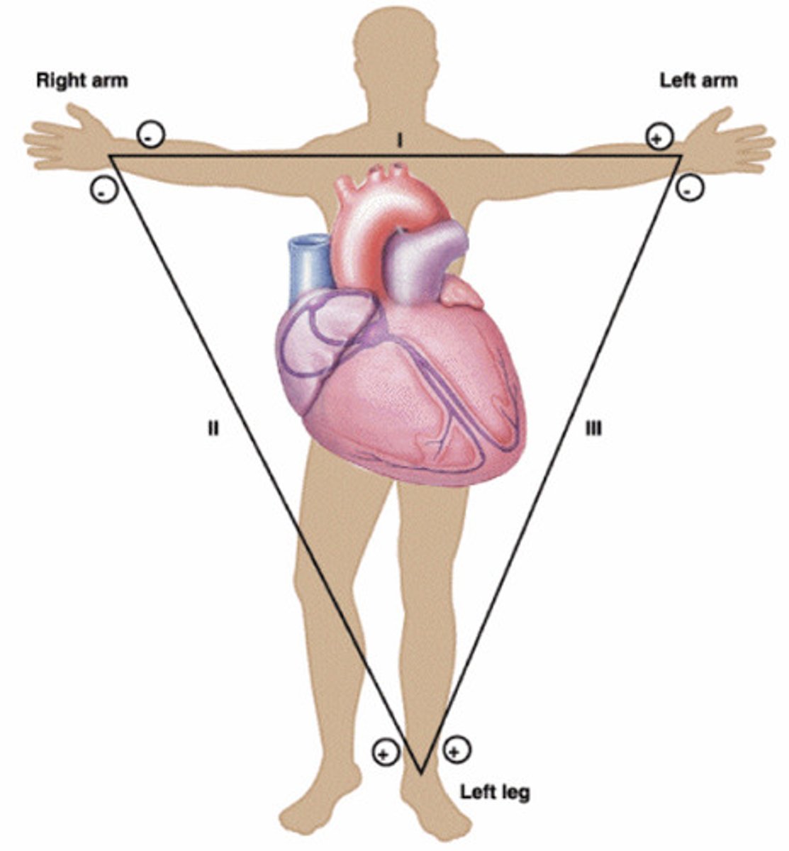 <p>Right arm negative pole</p><p>left arm positive pole</p><p>left leg positive pole</p>