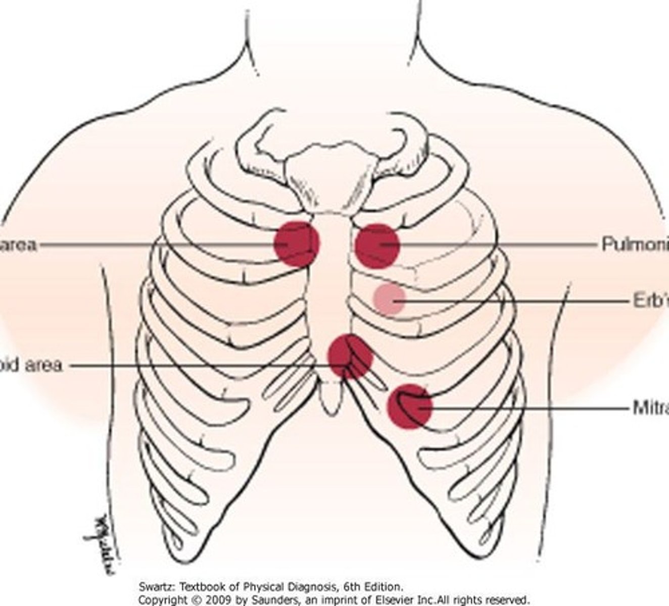 <p>2nd right intercostal space (ICS) for auscultation.</p>