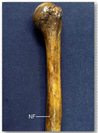 * The hole about midway on the diaphysis of a long bone through which the vessels which supply the bone with nutrients (ie arteries and veins) will travel.