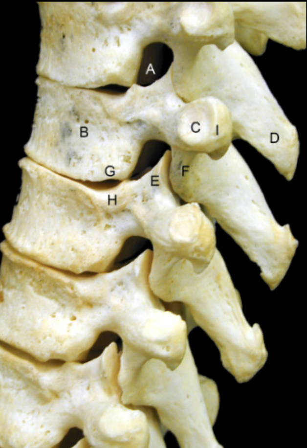 <p>Identify the Structures of the Thoracic Vertebrae - Lateral View</p>
