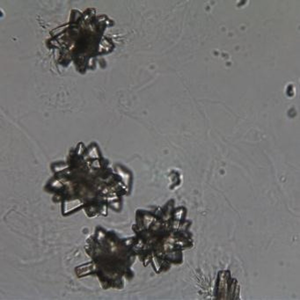 <p>Fine needles in clusters, dark yellow-brown, observed under Brightfield at 40x.</p>